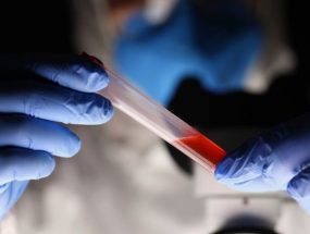 How a blood doping test is performed